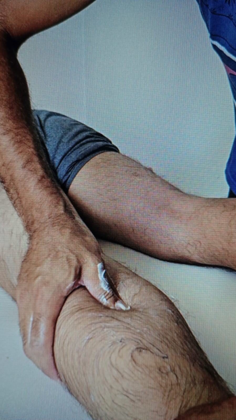 LIBERAÇÃO MIOFASCIAL