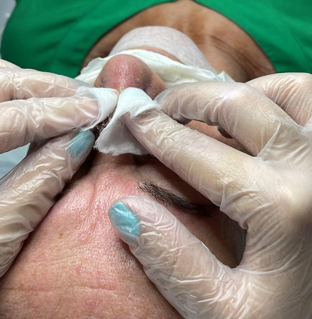 Limpeza de Pele 