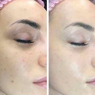 Curso Presencial de Especialização em BB GLOW