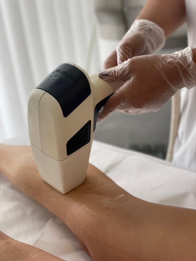 Depilação Laser