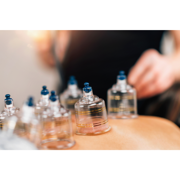 Curso EAD de Ventosaterapia