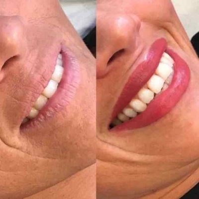 Curso Presencial de Especialização em Micropigmentação Labial