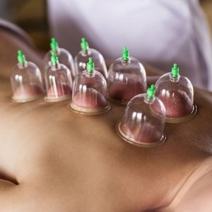 Massagem Terapêutica Ventosaterapia 5 sessões (Atendimento Fixo)