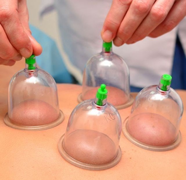 Massagem Terapêutica Ventosaterapia 5 sessões (Atendimento Fixo)