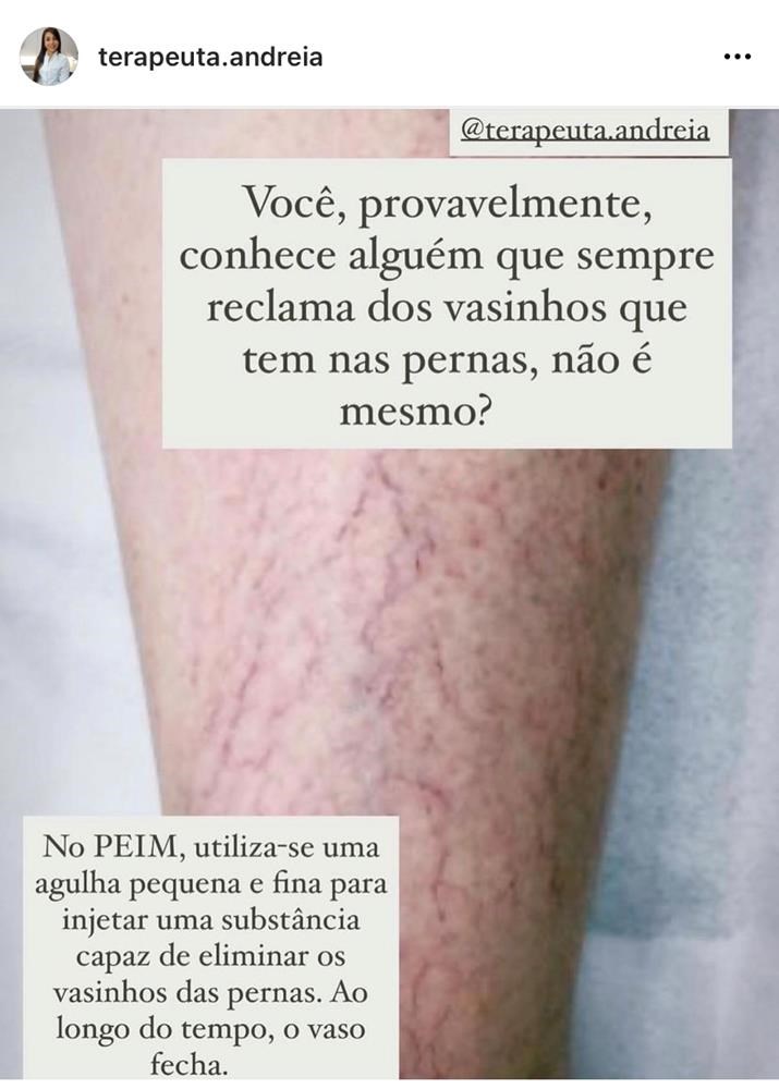 Tratamento Microvasos 