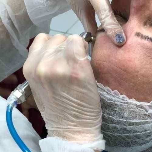 CURSO PRESENCIAL MASTER EM ESTÉTICA FACIAL