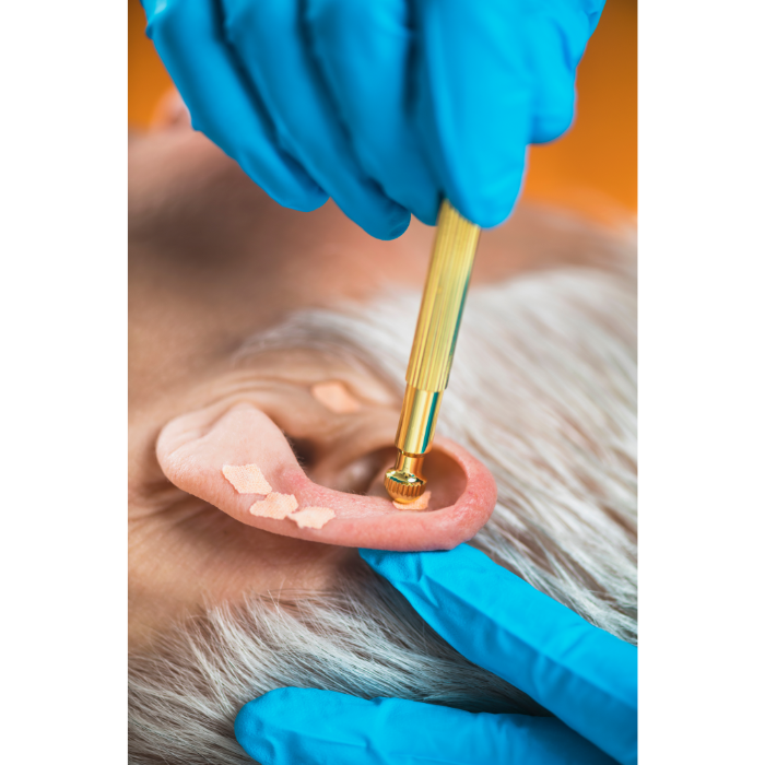 Curso EAD de Auriculoterapia