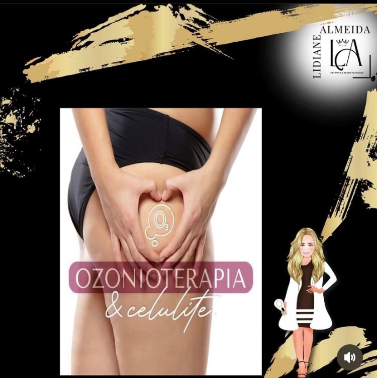 Ozônioterapia Na Estética 