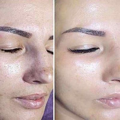 Curso Presencial de Especialização em BB GLOW